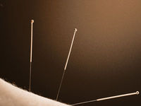 Medical_acupuncture5-spotlisting